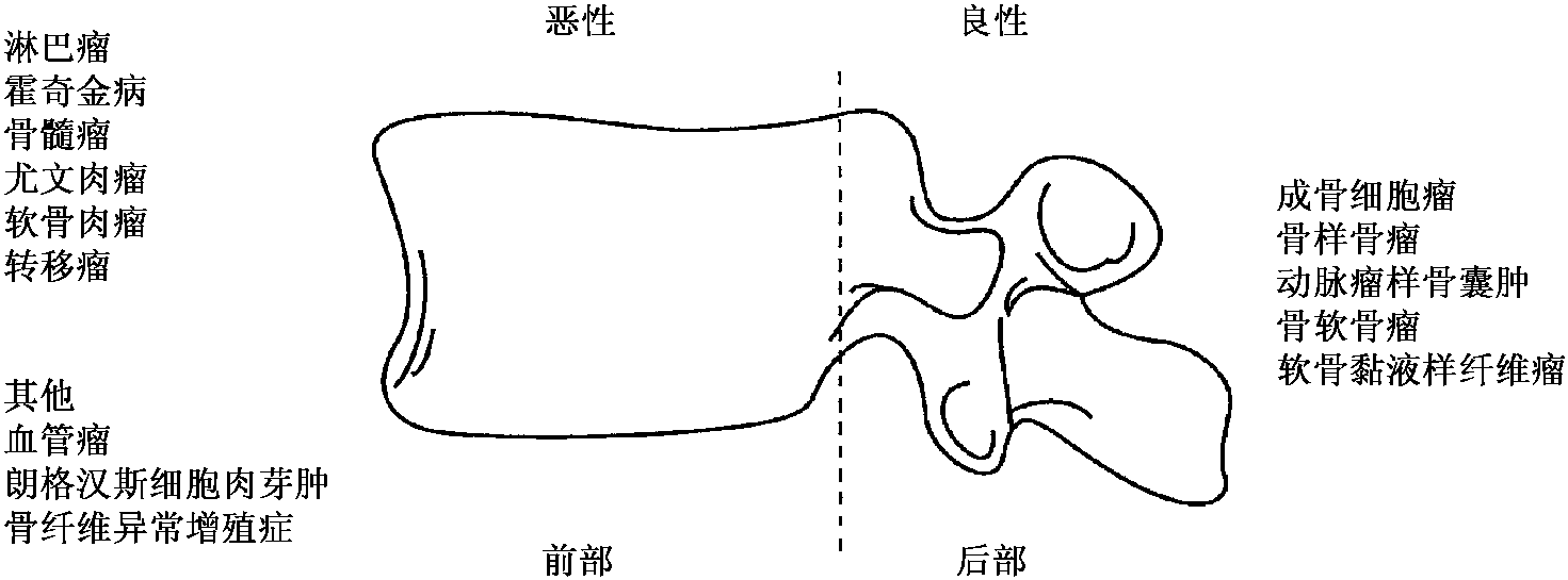 好发部位-临床X线鉴别诊断学-医学